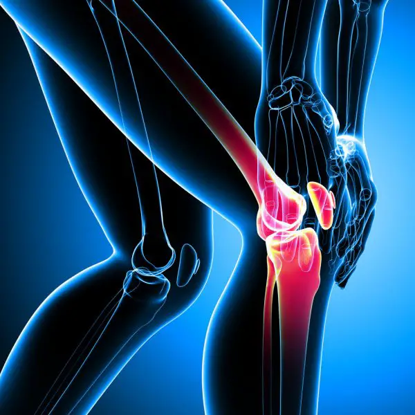 Arthrose soulager les douleurs du genou width1024