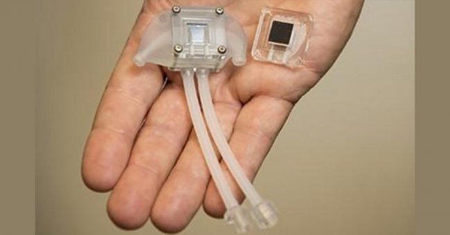 this artificial kidney could eliminate the need for kidney dialysis 650x340 1