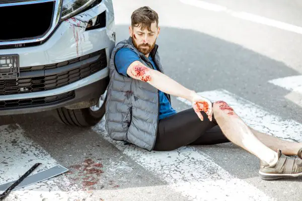 Injured man after the road accident